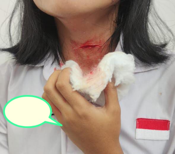 Siswi SMP 29 Jakarta Jadi Korban Penusukan di Halte Trans Jakarta CSW Bulungan ! Wah Rawan, Jangan Pandang Remeh, Evaluasi Sistem Keamanan