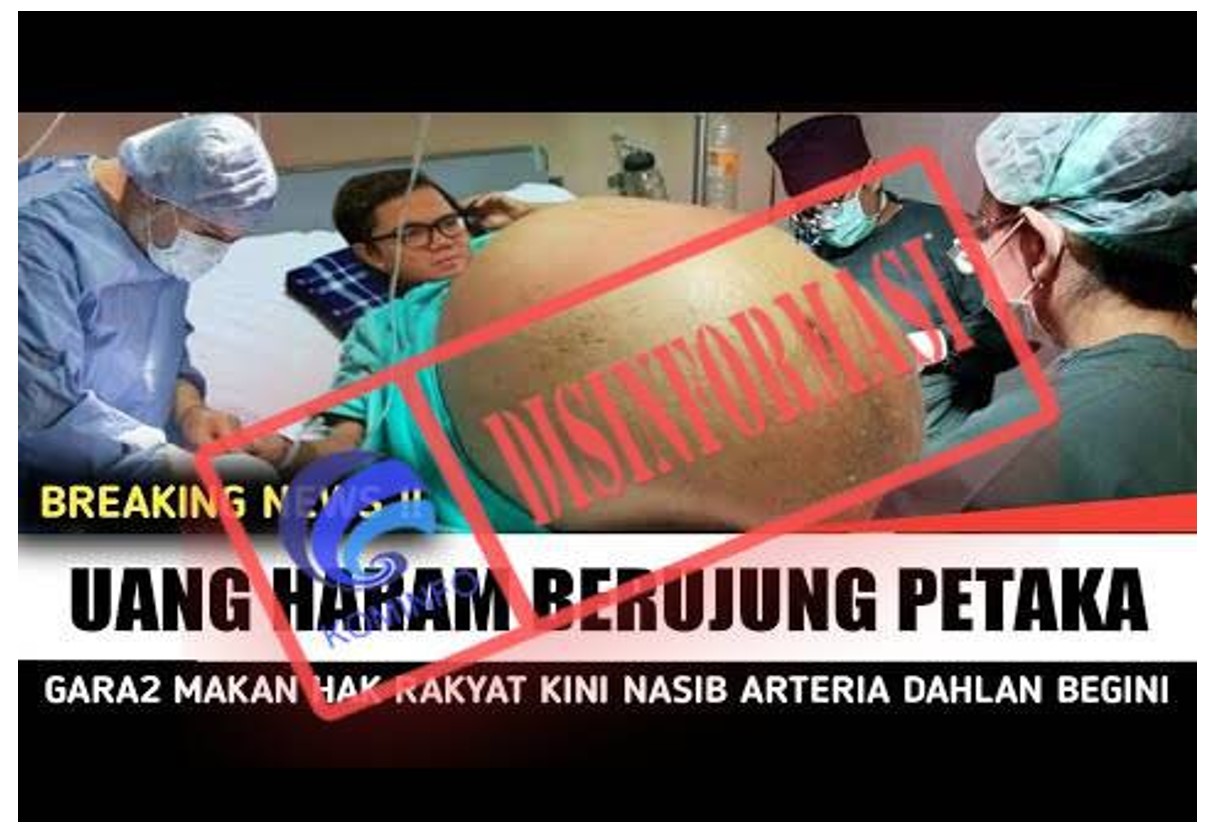 Arteria Dahlan Sakit Keras Kena Azab? Ternyata Hoaks! Cek Faktanya