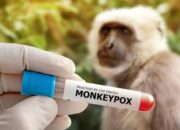 Belajar dari Covid-19, Anggota DPR Minta Pemerintah Tak Remehkan Mpox