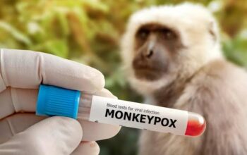 Kenali 2 Gejala Khas Monkeypox
