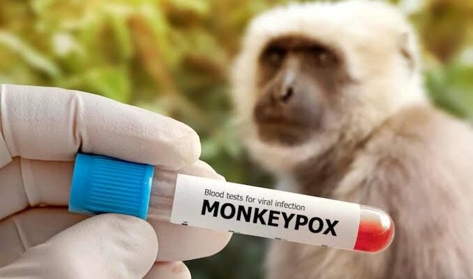 Kenali 2 Gejala Khas Monkeypox