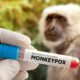Kenali 2 Gejala Khas Monkeypox