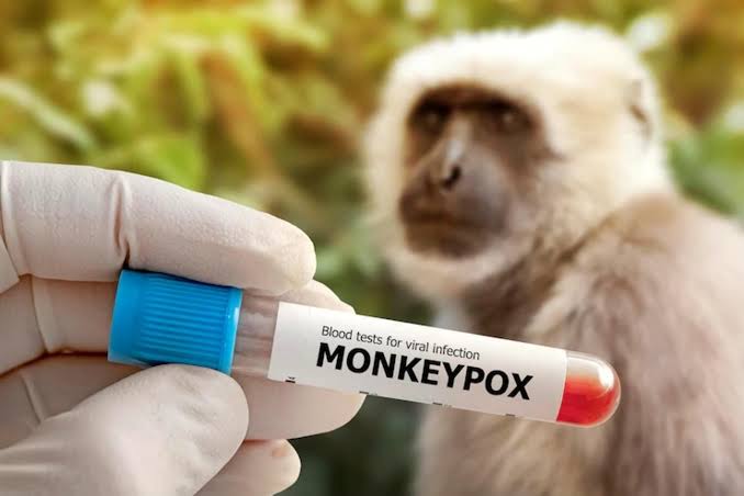 Kenali 2 Gejala Khas Monkeypox
