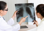 Menkes Luncurkan Inovasi Portable X-Ray Untuk Deteksi dan Lawan Tuberkulosis di Indonesia