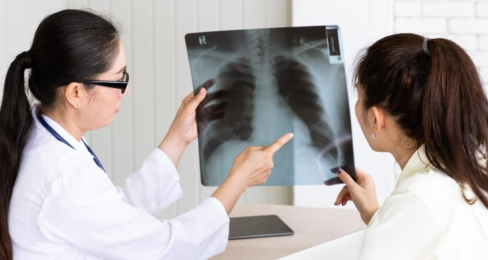Menkes Luncurkan Inovasi Portable X-Ray Untuk Deteksi dan Lawan Tuberkulosis di Indonesia
