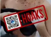 Hoax Kasus Mpox di Bali