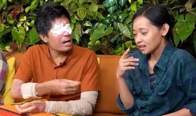 Donasi Agus Korban Penyiraman Air Keras Dipakai Belanja Online, Warganet Geram!