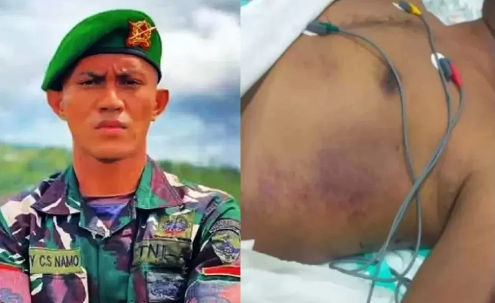 Tragedi di Asrama TNI, Prajurit Muda Tewas Diduga Dianiaya Senior
