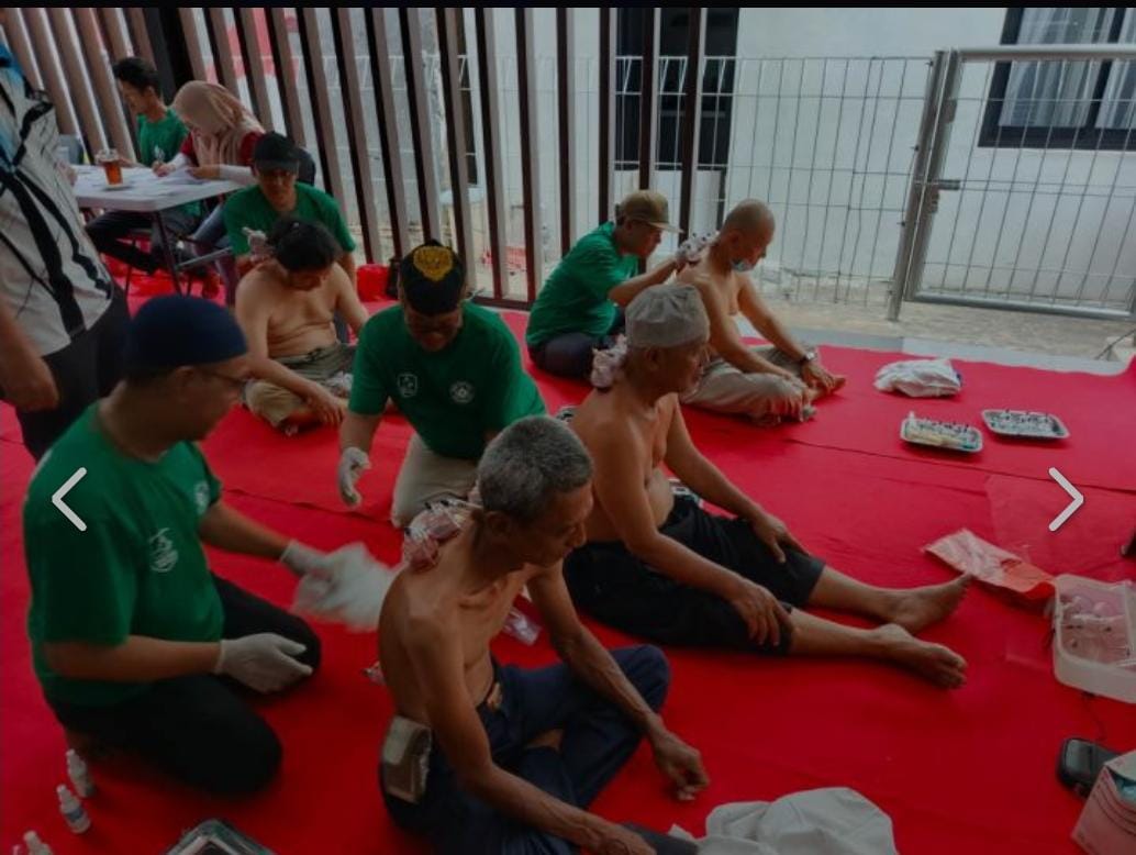 Aliansi Warga RW 01 Cipadu Kota Tangerang Hadirkan Layanan Bekam Gratis