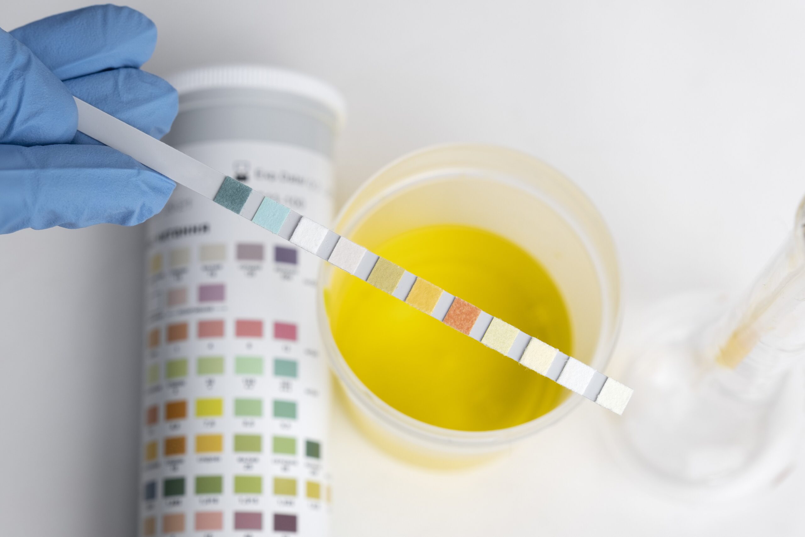 Tes Urine