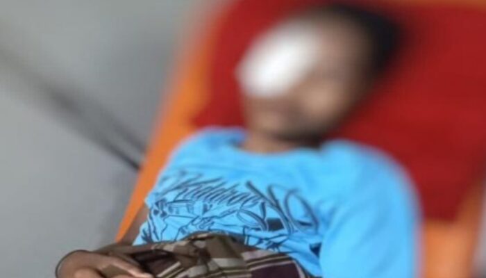Mata Remaja 15 Tahun di Gowa Luka Parah Ditembak Peluru Jeli, Polisi Kejar Pelaku