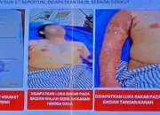 Kasus Penyiraman Andrie Yunus: Koalisi Tolak Peradilan Militer
