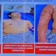Kondisi Andri