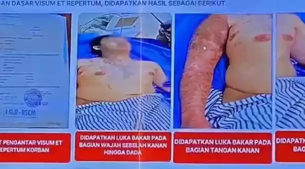 Kondisi Andri
