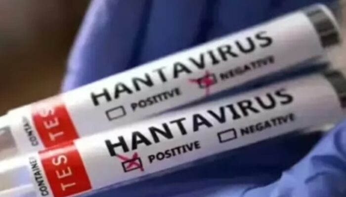 Kemenkes RI Perkuat Kesiapsiagaan Hadapi Ancaman Hantavirus