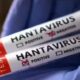 Kemenkes RI Perkuat Kesiapsiagaan Hadapi Ancaman Hantavirus